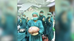 多年来以为只是肥胖 泰女腹中切出八公斤巨大卵巢囊肿